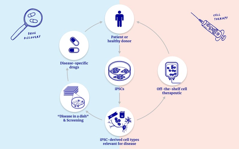 RZ_Grafik_iPSC-in-DD-celltherapy_210730_1